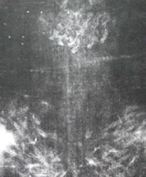 Negative of the Back of the Head of the Shroud of Turin