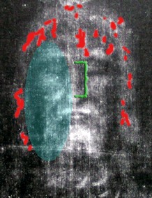 Negative of the Face on the Shroud of Turin with the injuries and Blood Marks Highlighted