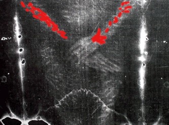Negative of the Hand Region of the Shroud of Turin, Blood Marks Highlighted