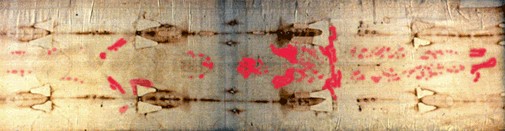 More apparent "Blood Marks" on the Shroud of Turin shown in Red
