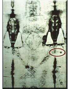 Blood Mark off the elbow