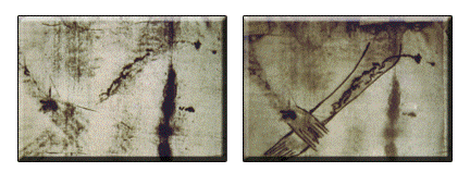 Tracing of Blood Mark off elbow